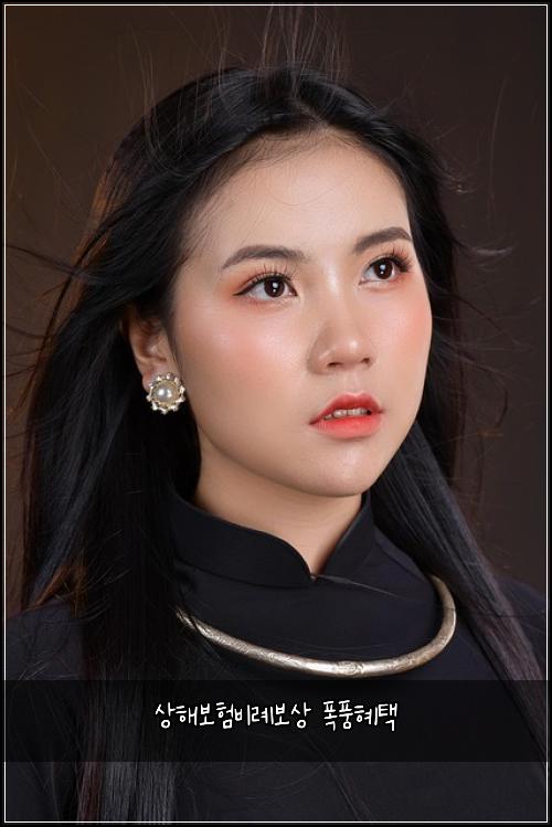 상해보험비례보상 폭풍혜택